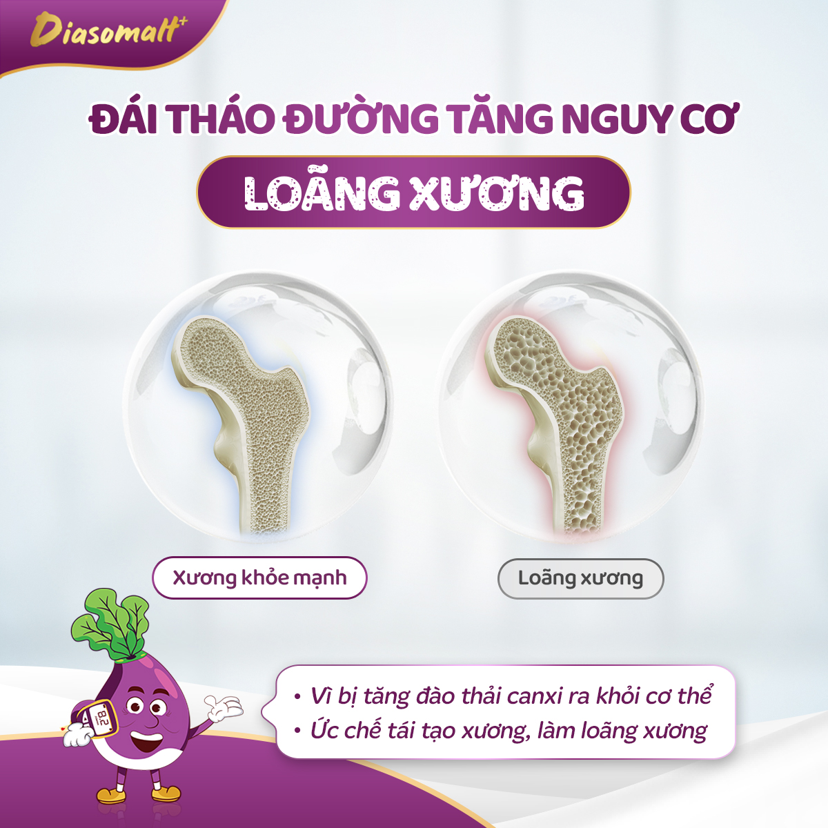 Đái tháo đường tăng nguy cơ loãng xương